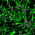 Astrocytes