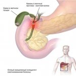 Back pain in the area of ​​the right shoulder blade