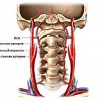 Duplex scanning of the carotid and vertebral arteries