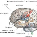 Инфографика