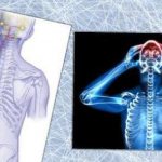 left-sided prosopalgia of the face