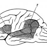 Localization of speech centers