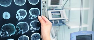 Менингиома головного мозга: прогноз жизни, отзывы о лечении
