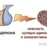 Mutation of a tumor into a malignant one