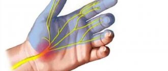 Neurolysis of peripheral nerves of the extremities