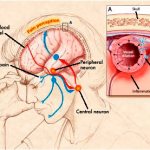 Pathogenesis of migraine