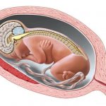 The process of neural tube formation and developmental defects