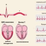 registration of tachyarrhythmia attack