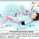 Symptoms of serotonin syndrome