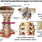 вертебробазилярная-недостаточность