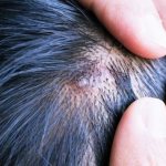 Types and causes of hair bumps on the head